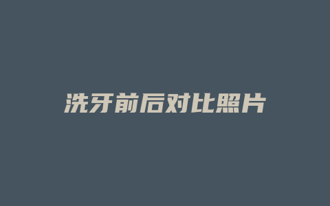 洗牙前后对比照片