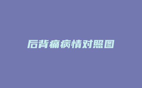 后背痛病情对照图